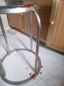 孩子流产了，这几天人都是恍惚的-灰豹网络